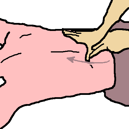 Picture, Massage Technique: Stripping