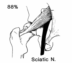 pPiriSciatic88