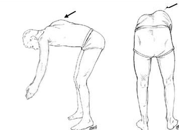 adams test