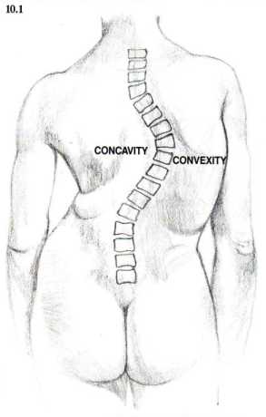 Scoliosis from Behind