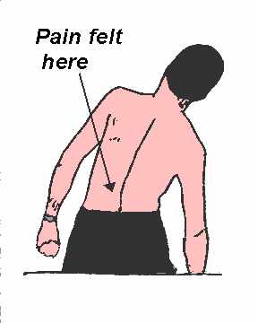 Pain in lower back right side